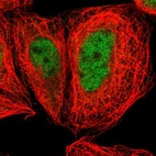 Immunofluorescent staining of human cell line A-431 shows localization to nucleoplasm.