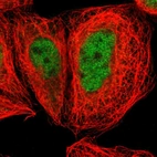 Immunofluorescent staining of human cell line A-431 shows localization to nucleoplasm.