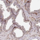 Immunohistochemical staining of human prostate shows strong cytoplasmic positivity in basal layer of glandular cells.