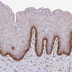 Anti-ZNF268 Antibody