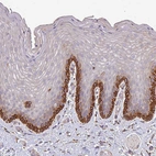 Immunohistochemical staining of human skin shows strong cytoplasmic positivity in basal epidermal cells.