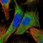 Immunofluorescent staining of human cell line U-251 MG shows localization to cytosol.