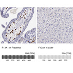 Anti-F13A1 Antibody