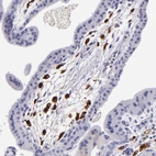 Immunohistochemical staining of human placenta shows strong cytoplasmic positivity in Hofbauer cells.