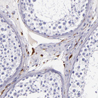 Immunohistochemical staining of human testis shows strong cytoplasmic positivity in macrophages.