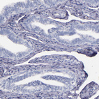 Immunohistochemical staining of human fallopian tube shows no positivity in glandular cells as expected.