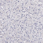Immunohistochemical staining of human liver shows no positivity in hepatocytes as expected.
