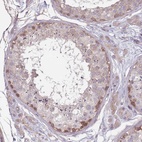 Anti-SAV1 Antibody
