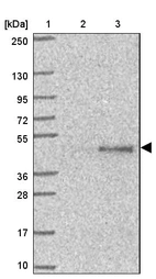 Lane 1: Marker [kDa] 250, 130, 95, 72, 55, 36, 28, 17, 10_br/_Lane 2: Human cell line RT-4_br/_Lane 3: Human cell line U-251MG sp