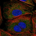 Immunofluorescent staining of human cell line SiHa shows localization to cytosol.