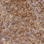 Immunohistochemical staining of human lymph node shows moderate to strong cytoplasmic positivity in lymphoid cells.