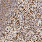 Immunohistochemical staining of human spleen shows moderate to strong cytoplasmic positivity in cells in red pulp.
