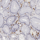 Immunohistochemical staining of human stomach shows moderate to strong cytoplasmic positivity in lymphoid cells.