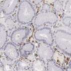 Immunohistochemical staining of human stomach shows moderate to strong cytoplasmic positivity in lymphoid cells.