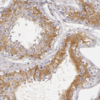 Anti-APOBEC3G Antibody