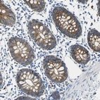 Immunohistochemical staining of human colon shows moderate cytoplasmic and membranous positivity in glandular cells.