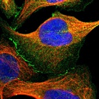 Immunofluorescent staining of human cell line U-2 OS shows positivity in plasma membrane, cytoplasm & cell junctions.