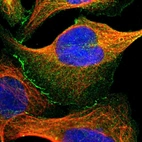 Immunofluorescent staining of human cell line U-2 OS shows positivity in plasma membrane, cytoplasm & cell junctions.