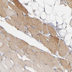 Anti-SOD2 Antibody
