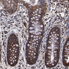 Immunohistochemical staining of human colon shows strong granular cytoplasmic positivity in glandular cells.