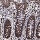 Immunohistochemical staining of human colon shows strong granular cytoplasmic positivity in glandular cells.
