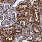 Immunohistochemical staining of human kidney shows strong granular cytoplasmic positivity in cells in tubules.