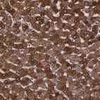 Immunohistochemical staining of human liver shows strong granular cytoplasmic positivity in hepatocytes.