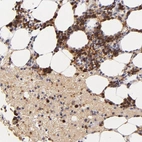 Anti-SERPINC1 Antibody