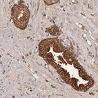 Anti-CFB Antibody