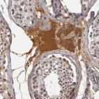 Immunohistochemical staining of human testis shows moderate cytoplasmic positivity in Leydig cells.