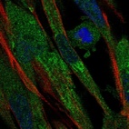 Immunofluorescent staining of human cell line ASC TERT1 shows localization to endoplasmic reticulum.