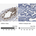 Anti-CREM Antibody