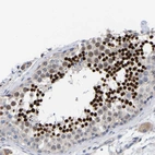 Immunohistochemical staining of human testis shows strong nuclear positivity in spermatids.