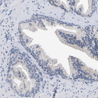 Anti-CREM Antibody