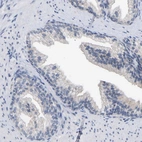Immunohistochemical staining of human prostate shows no nuclear positivity in glandular cells as expected.