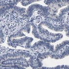 Immunohistochemical staining of human fallopian tube shows no nuclear positivity in glandular cells as expected.