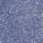 Anti-CREM Antibody