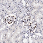 Anti-SRF Antibody
