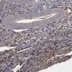 Immunohistochemical staining of human Endometrium shows moderate cytoplasmic positivity in cells in endometrial stroma.