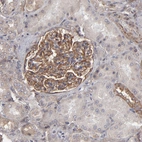 Immunohistochemical staining of human Kidney shows moderate membranous and cytoplasmic positivity in cells in glomeruli.