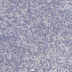 Anti-ITGB5 Antibody