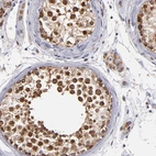 Immunohistochemical staining of human testis shows high expression.