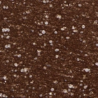 Immunohistochemical staining of human cerebral cortex shows strong positivity in neuropil.