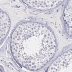 Immunohistochemical staining of human testis shows no positivity in cells in seminiferous ducts as expected.