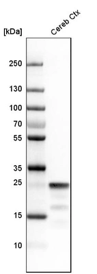 Western blot analysis in mouse cerebral cortex tissue.