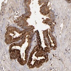 Anti-CFB Antibody