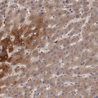 Anti-CP Antibody