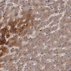 Anti-CP Antibody