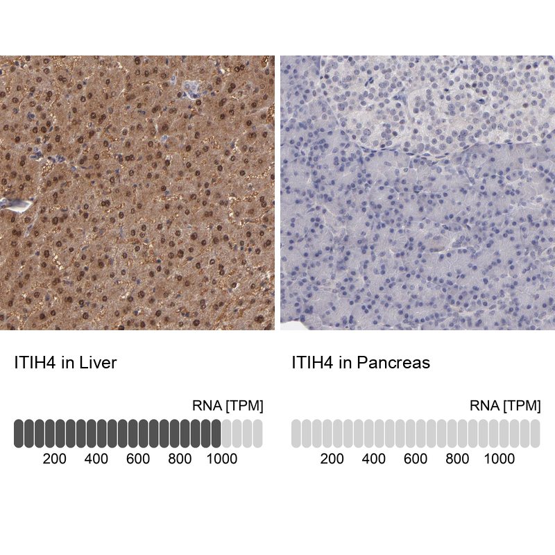 Anti-ITIH4 Antibody