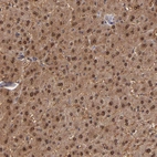 Immunohistochemical staining of human liver shows strong cytoplasmic and nuclear positivity in hepatocytes.